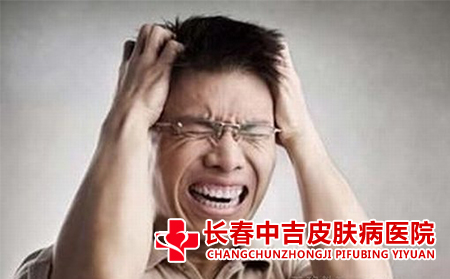 青春痘应该怎么治疗
