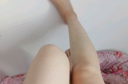 鱼鳞病开始变淡
