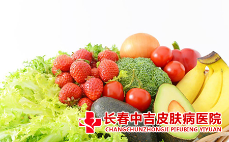 鱼鳞病患者应该怎么进行治疗