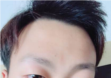 偏高的发髻线