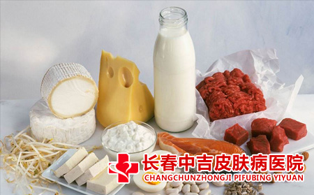 荨麻疹清淡饮食