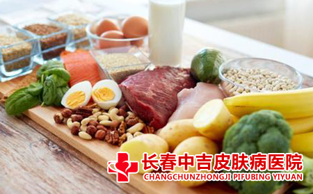 鱼鳞病患者应该怎么进行治疗