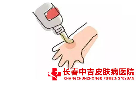 痤疮的治疗方式有什么