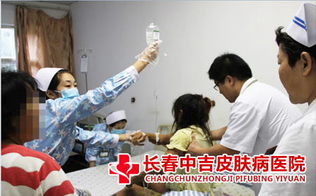 鱼鳞病患者合适选择的治疗方式有什么