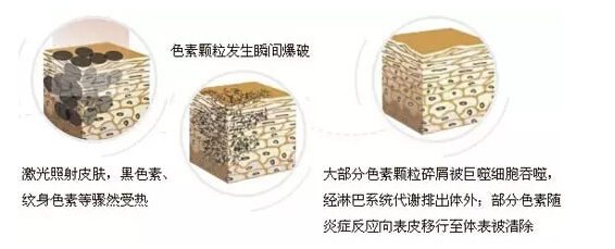 黑素排除的过程