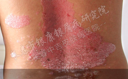 长春哪看皮肤不错