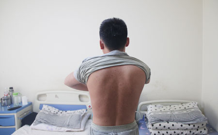 长春哪里合适治牛皮癣