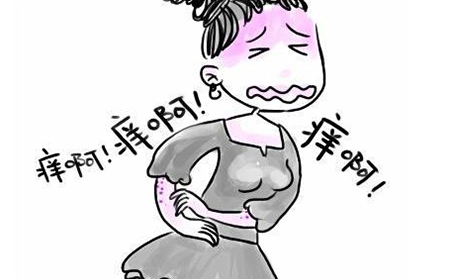 牛皮癣患者应该注意什么