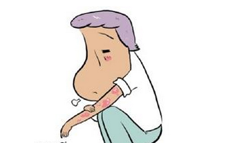 牛皮癣的症状有什么