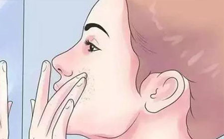 女性牛皮癣的症状有什么