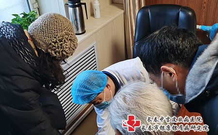 四平哪家牛皮癣看得好