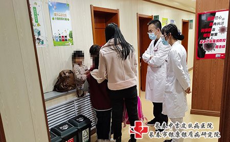 四平哪家牛皮癣科好