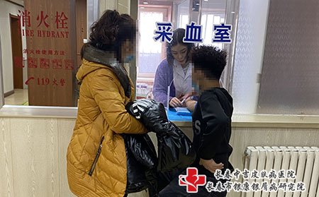 松原的治疗牛皮癣的好医院