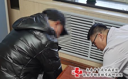 牛皮癣医生张贵麟在哪家医院接诊