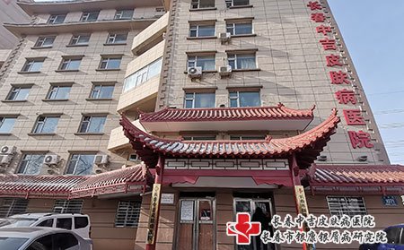 牛皮癣医生于海明口碑好吗