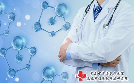 夏季怎样治红皮型牛皮癣,红皮型牛皮癣怎样治