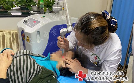 在长春的牛皮癣医院哪家比较靠谱