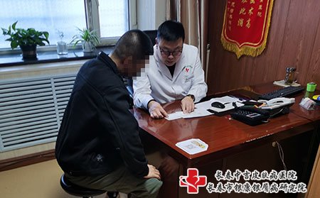 在长春得了牛皮癣要怎么治