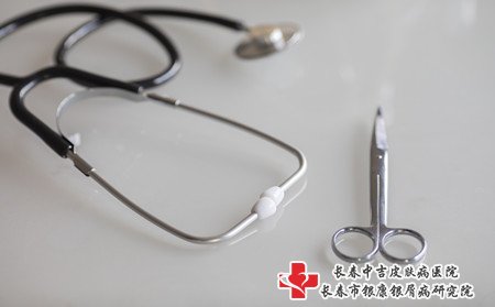 辽源哪里治牛皮癣,去辽源哪里治牛皮癣