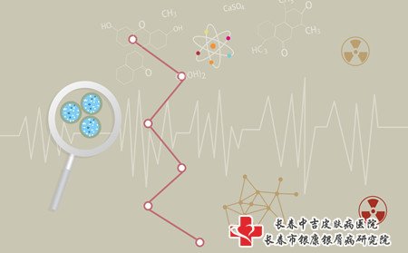 通化牛皮癣医院,通化哪里治牛皮癣
