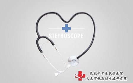 儿童有牛皮癣怎么办,脸上有牛皮癣怎么办