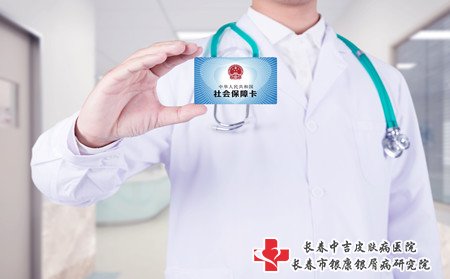 关节型牛皮癣治疗,怎么治关节型牛皮癣好