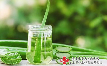 长春中吉,牛皮癣,家庭护理