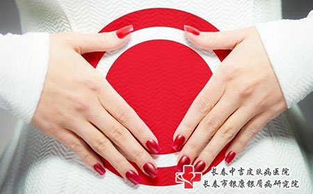 长春中吉牛皮癣医院牛皮癣自然护理