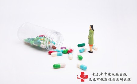 四平治牛皮癣的医院,四平哪儿治牛皮癣
