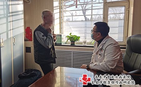 在长春去哪里治疗寻常牛皮癣好