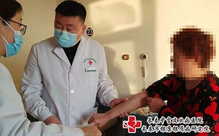 在长春看脓疱型牛皮癣哪个医院治疗好