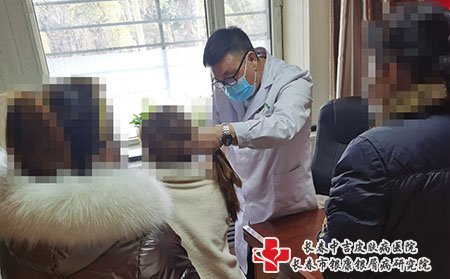 在长春哪家医院治疗牛皮癣的效果好