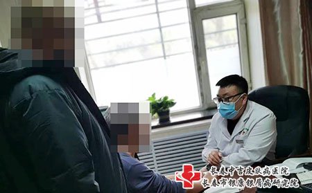 在长春看牛皮癣选哪家医院好