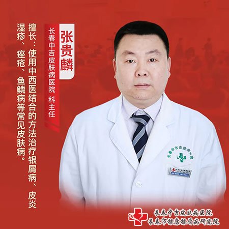 长春市中吉牛皮癣医院张贵麟主任