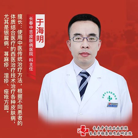长春市中吉牛皮癣医院于海明主任