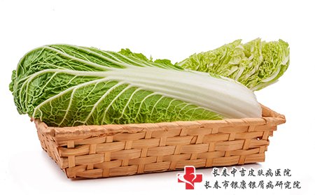 牛皮癣