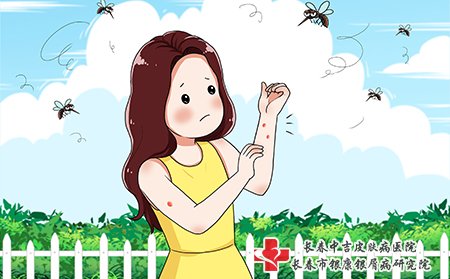 牛皮癣