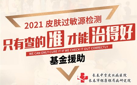 长春市中吉牛皮癣医院2021皮肤过敏原检测公益基金援助