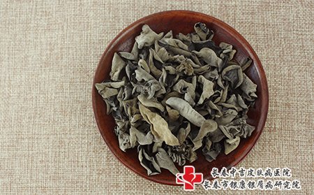 牛皮癣