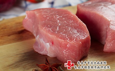 牛皮癣
