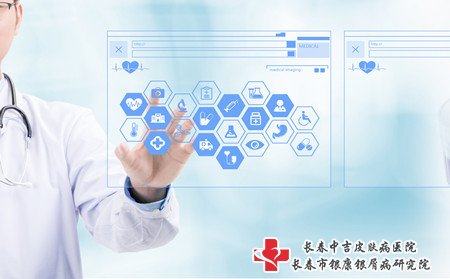 男性牛皮癣护理,怎样护理男性牛皮癣