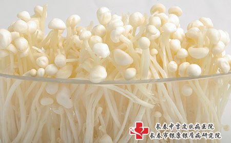 牛皮癣