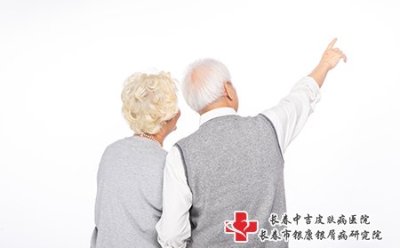 牛皮癣
