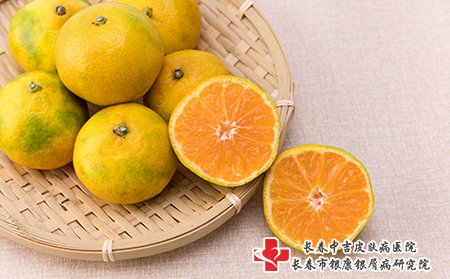 牛皮癣