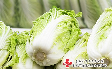牛皮癣