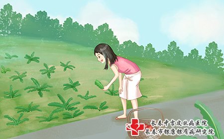 牛皮癣