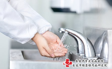 牛皮癣