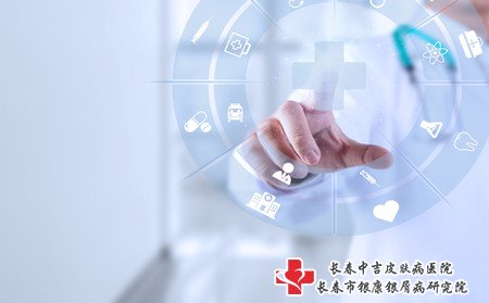 通化牛皮癣治疗,通化哪家医院治牛皮癣