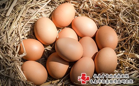 牛皮癣患者是可以吃鸡蛋的，有一些注意事项。