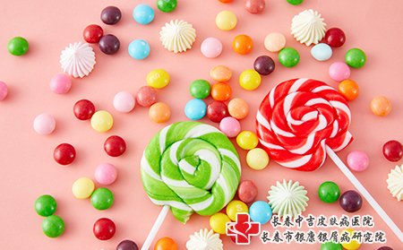 牛皮癣不能吃太多糖、油腻食物还有辛辣刺激的食物
